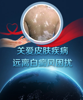 皮肤病西安