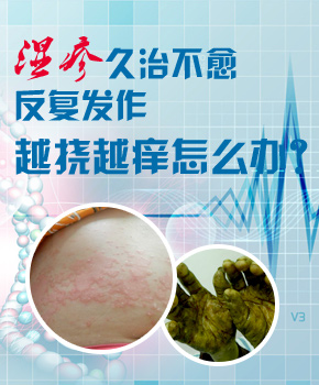 西安皮炎医院